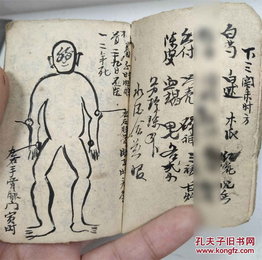 痘疮 痘疮病怎么治 痘疮 痘疮 痘疮病怎么治 痘疮