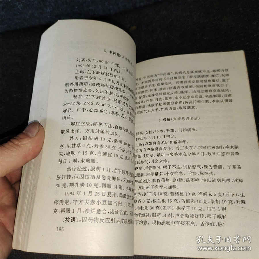 【吉尼环的价格】费用多少钱